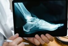 regional call analysis report